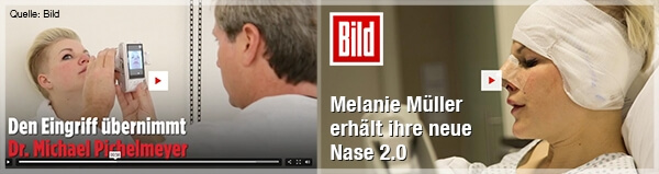 Bericht Bild - Nasenkorrektur Melanie Müller
