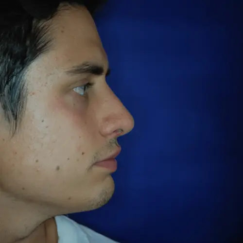 Nachher